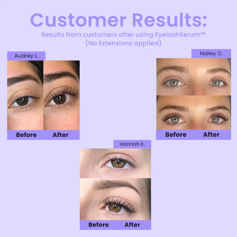 1+1 FREE Eyelash Serum™ - Instant Dream Lashes! - Image 3