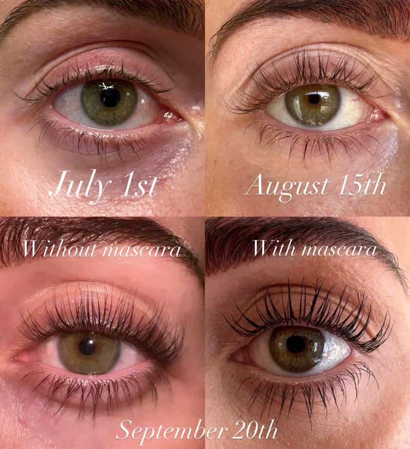 1+1 FREE Eyelash Serum™ - Instant Dream Lashes! - Image 5