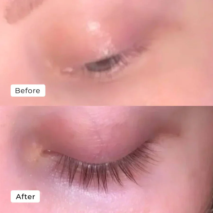 1+1 FREE Eyelash Serum™ - Instant Dream Lashes! - Image 7
