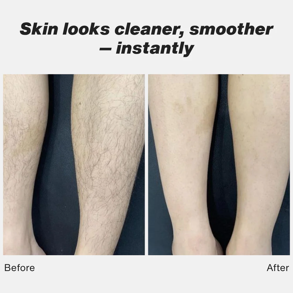 1X Lima Shave™ — Glide Into Every Curve for a Smooth, Irritation-Free Shave - Image 5