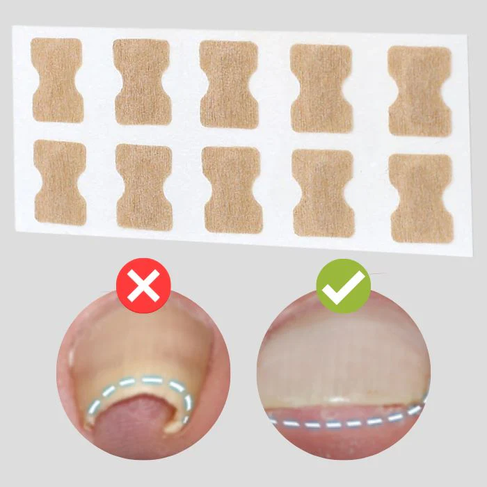 AuraStep™ — Step Confidently with Pain-Free, Perfectly Straight Nails - Image 2