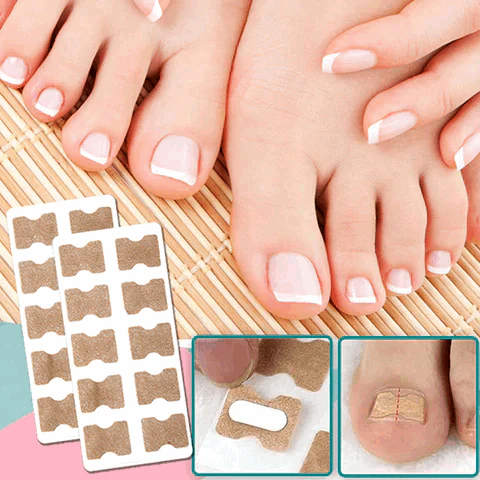 AuraStep™ — Step Confidently with Pain-Free, Perfectly Straight Nails - Image 3
