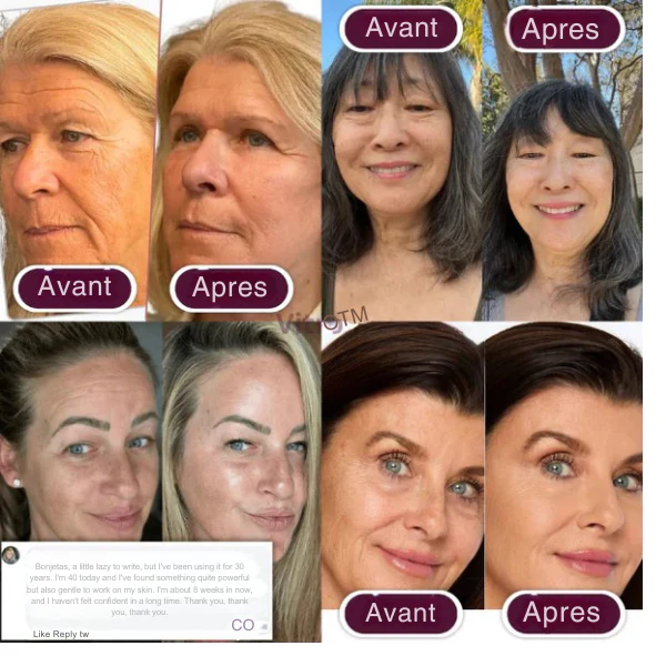 RadiantMorph™ — Unlock Youthful Glow and Firmness in Just 10 Seconds a Day - Image 2