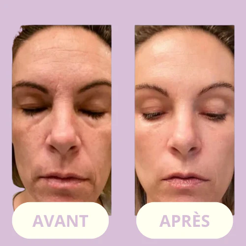 ClearSkin Wand™ - Image 5