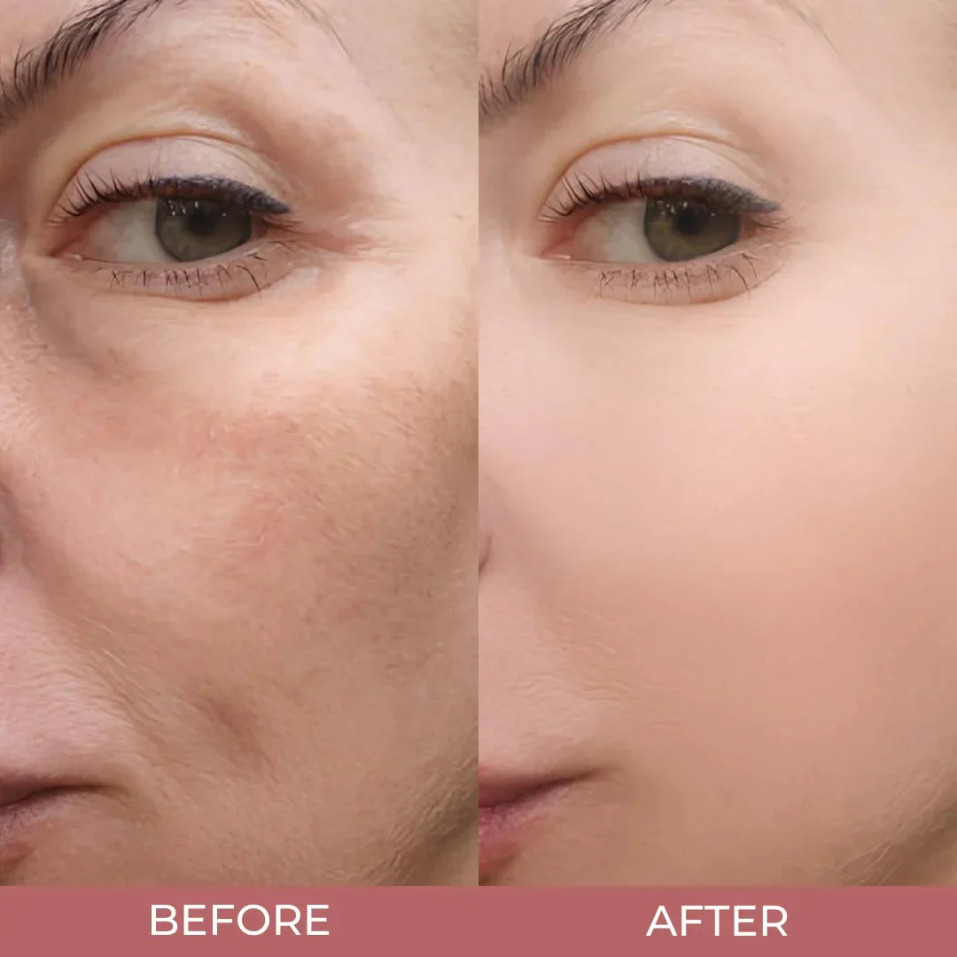 Arvilaro's Peel Shot Glow Rice Ampoule - Image 5