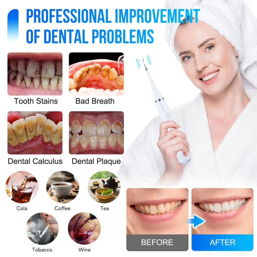 DentiPulse™ — Feel the Power of a Dentist-Deep Clean for a Stunning, Confident Smile Every Day - Image 2
