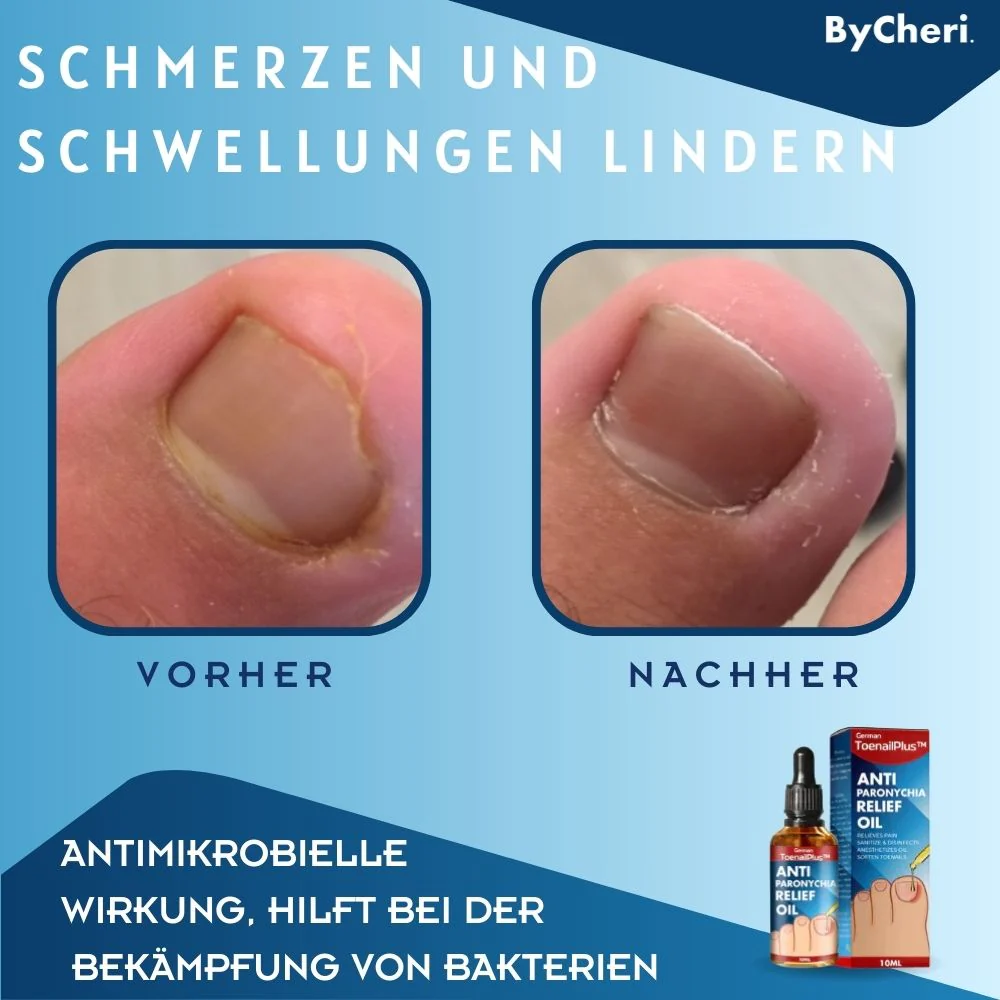 DermGuard™ — Walk Proud with Pain-Free, Beautiful Nails Fast - Image 3