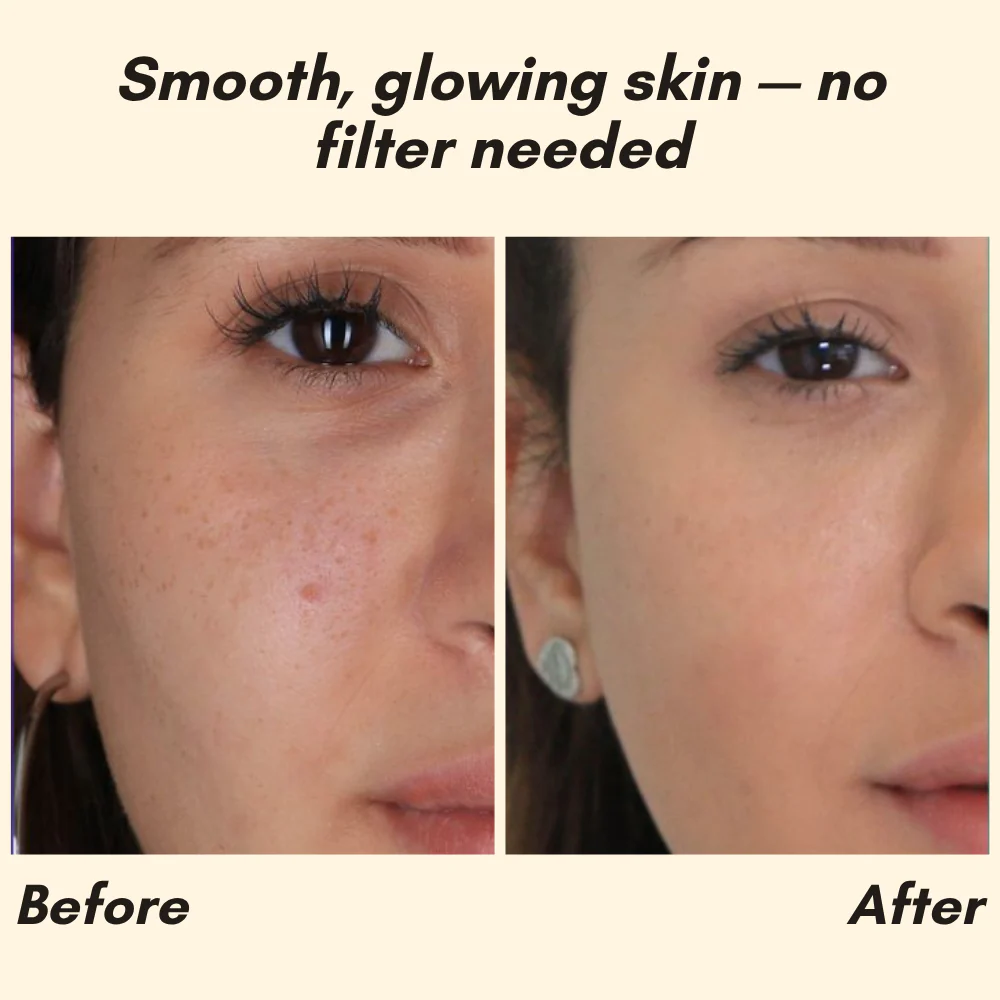 EELHOE Eternity™ — Erase Dark Spots, Reveal Glowing Skin | 1+1 FREE - Image 3