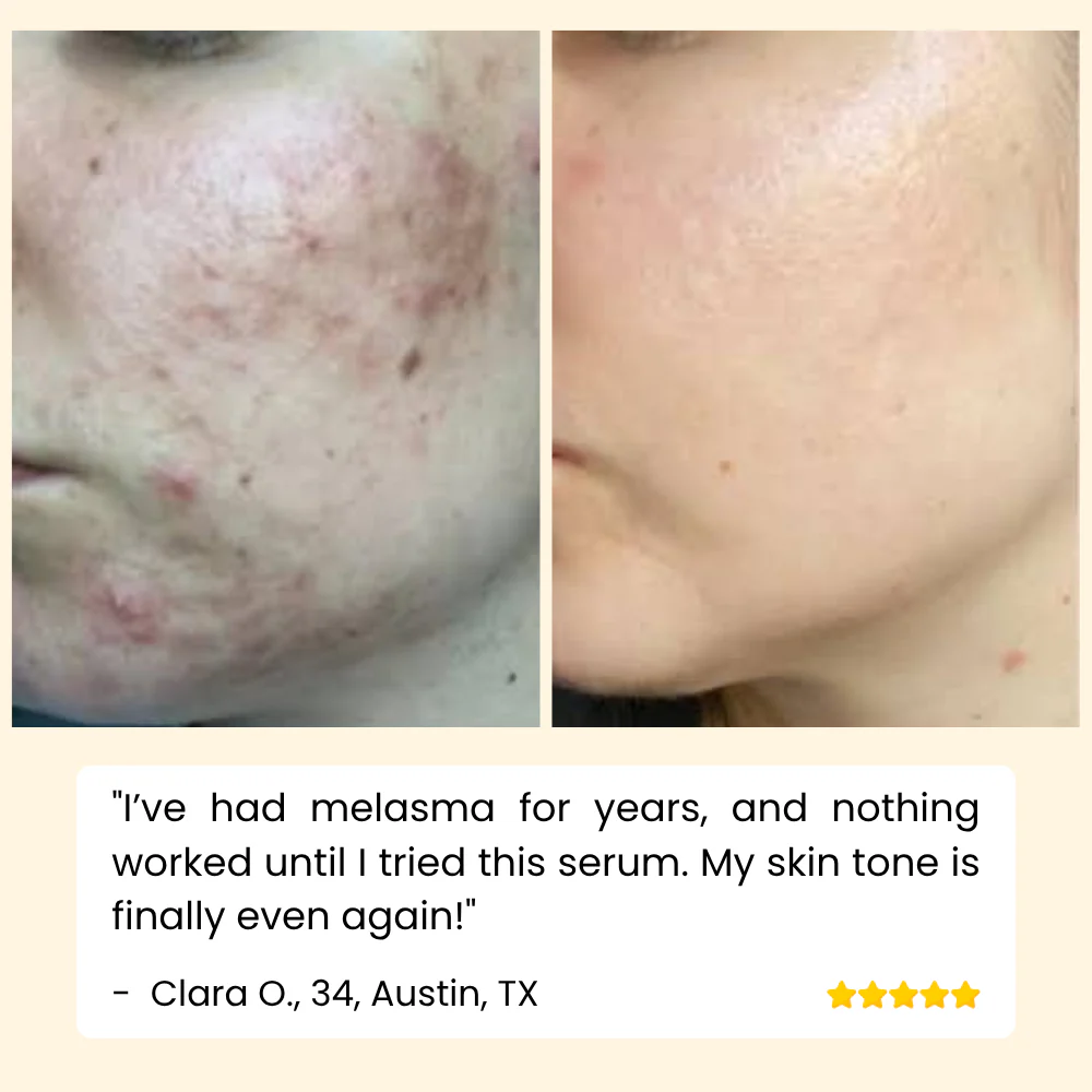 EELHOE Eternity™ — Erase Dark Spots, Reveal Glowing Skin | 1+1 FREE - Image 8