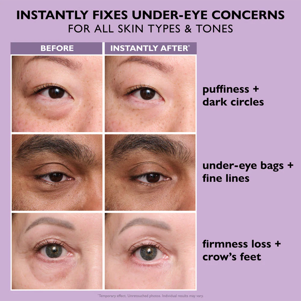 FirmLyft™ — Instantly Lift and Renew Tired Eyes for All-Day Radiance - Image 4