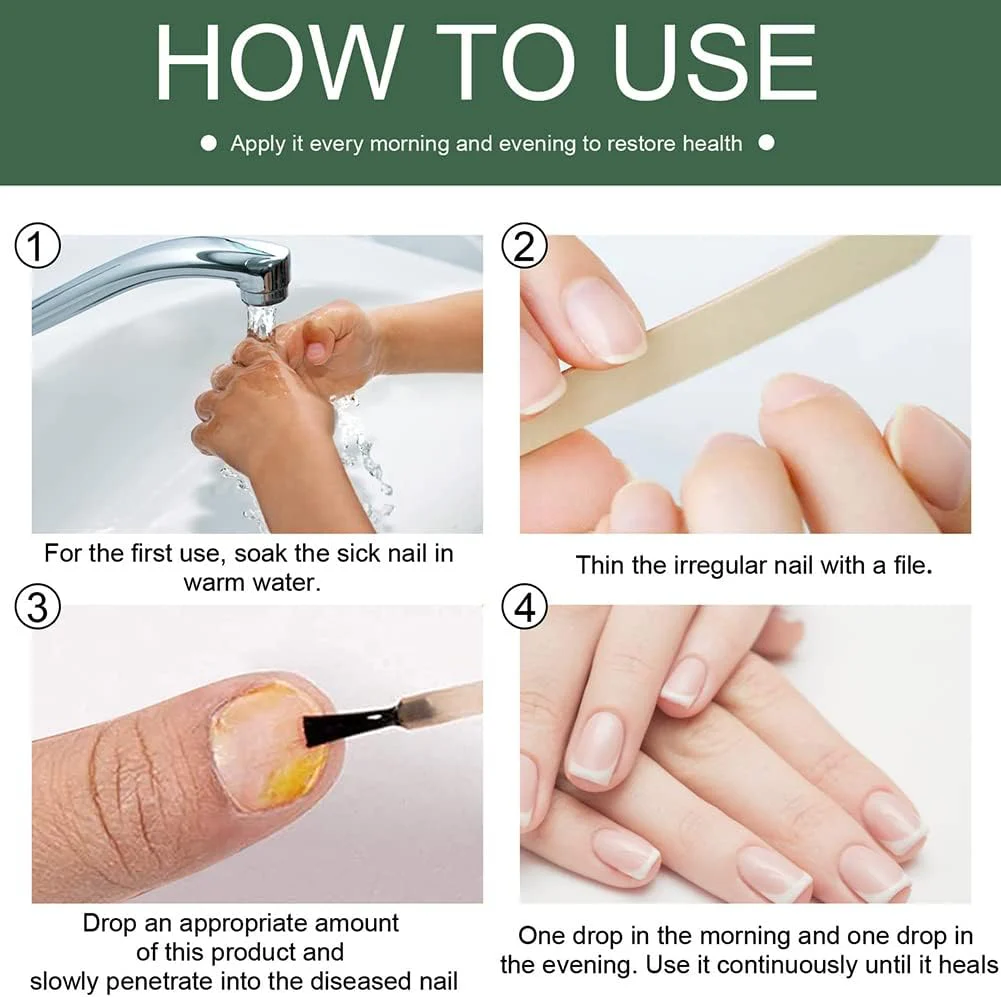 FungiFreeze™ — Unlock Clear, Healthy Nails and Step Out with Confidence - Image 8
