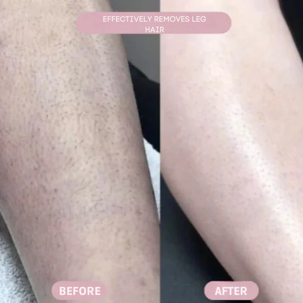 GlideAura™ — Experience Silky-Smooth Skin Without a Single Nick or Bump - Image 4