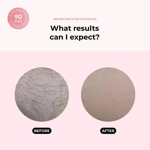 GlideGlint™ — Experience Smooth, Irritation-Free Skin That Boosts Your Confidence Instantly - Image 3