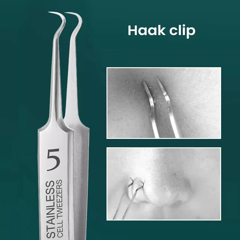 GlideSkin™ — Unleash Your Glow with Painless, Precision Blackhead Removal - Image 4
