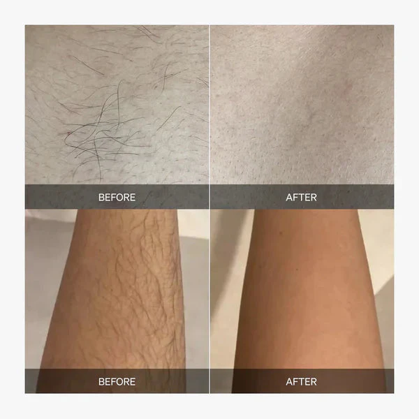 Glissara™ — Effortless, Pain-Free Smoothness That Lasts for Weeks - Image 10