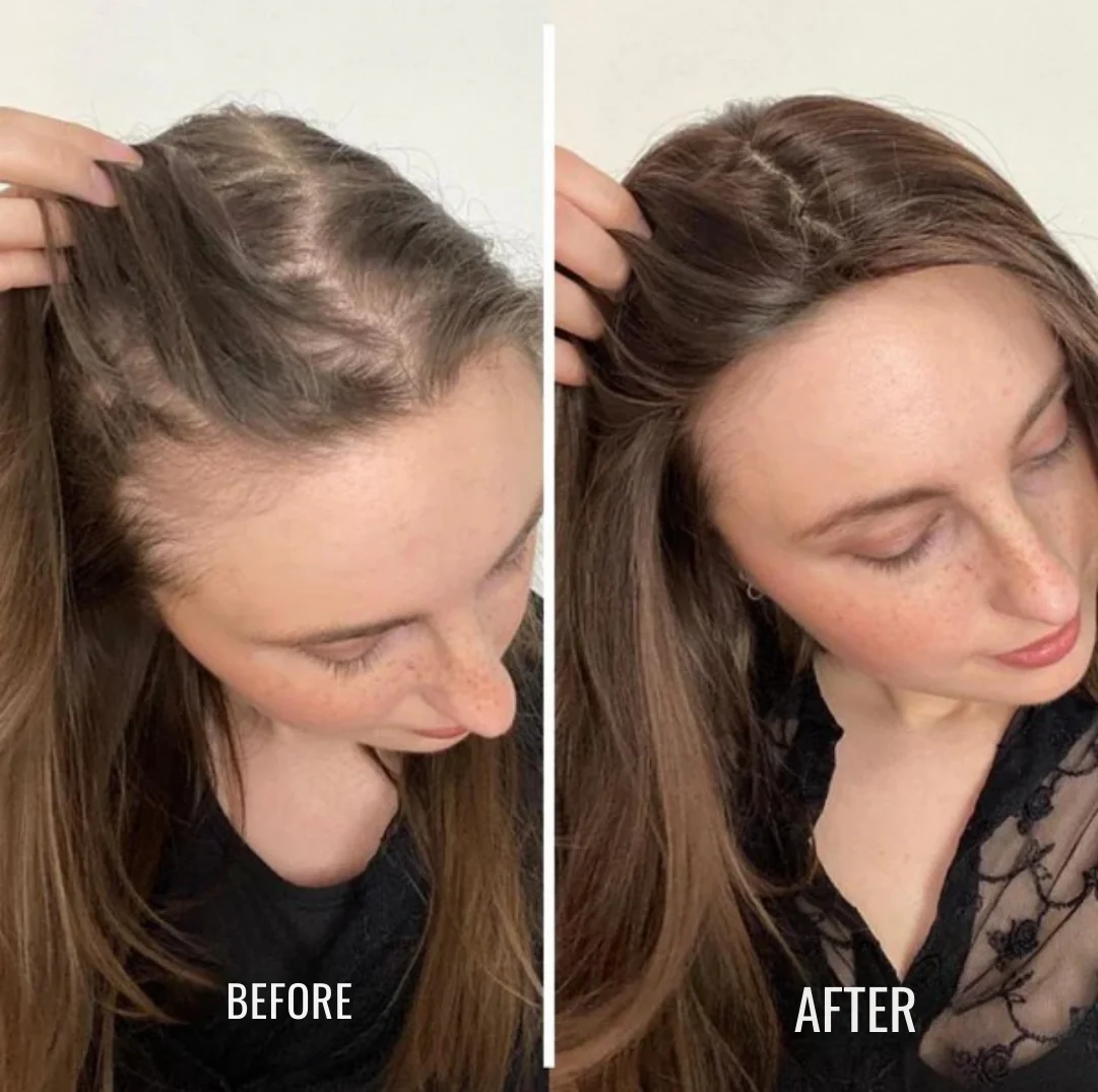 GlowRoot™ Hair Elixir — Awakens Your Scalp to Thicker, Fuller, Irresistible Hair - Image 8