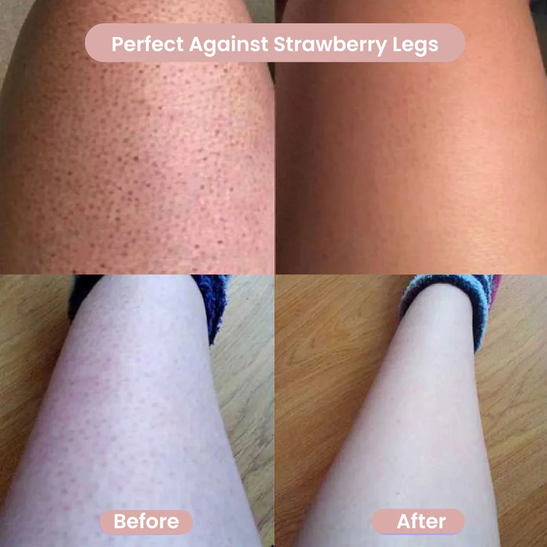 GlowShave™ – 2-in-1 Women’s Body Shaver - Image 6