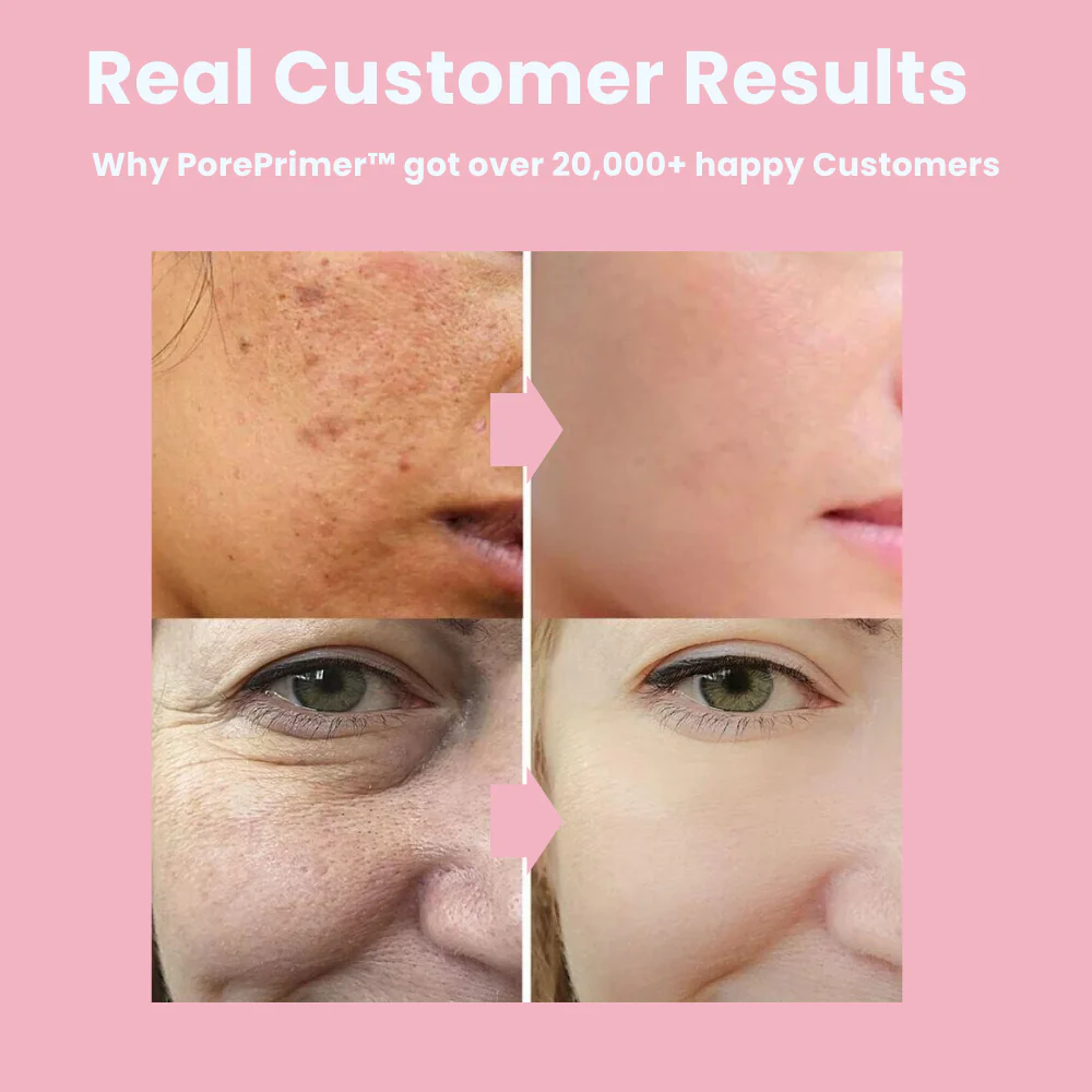 PorePrimer™ The invisible Poor Cream | FLASH SALE: 1+1 FREE - Image 8