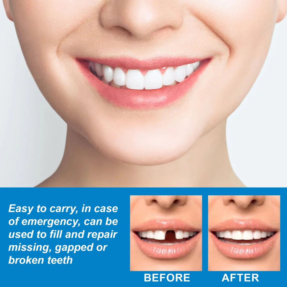 InstantSmile™ — Confidently Fill Gaps and Shine Bright Anywhere, Anytime - Image 4