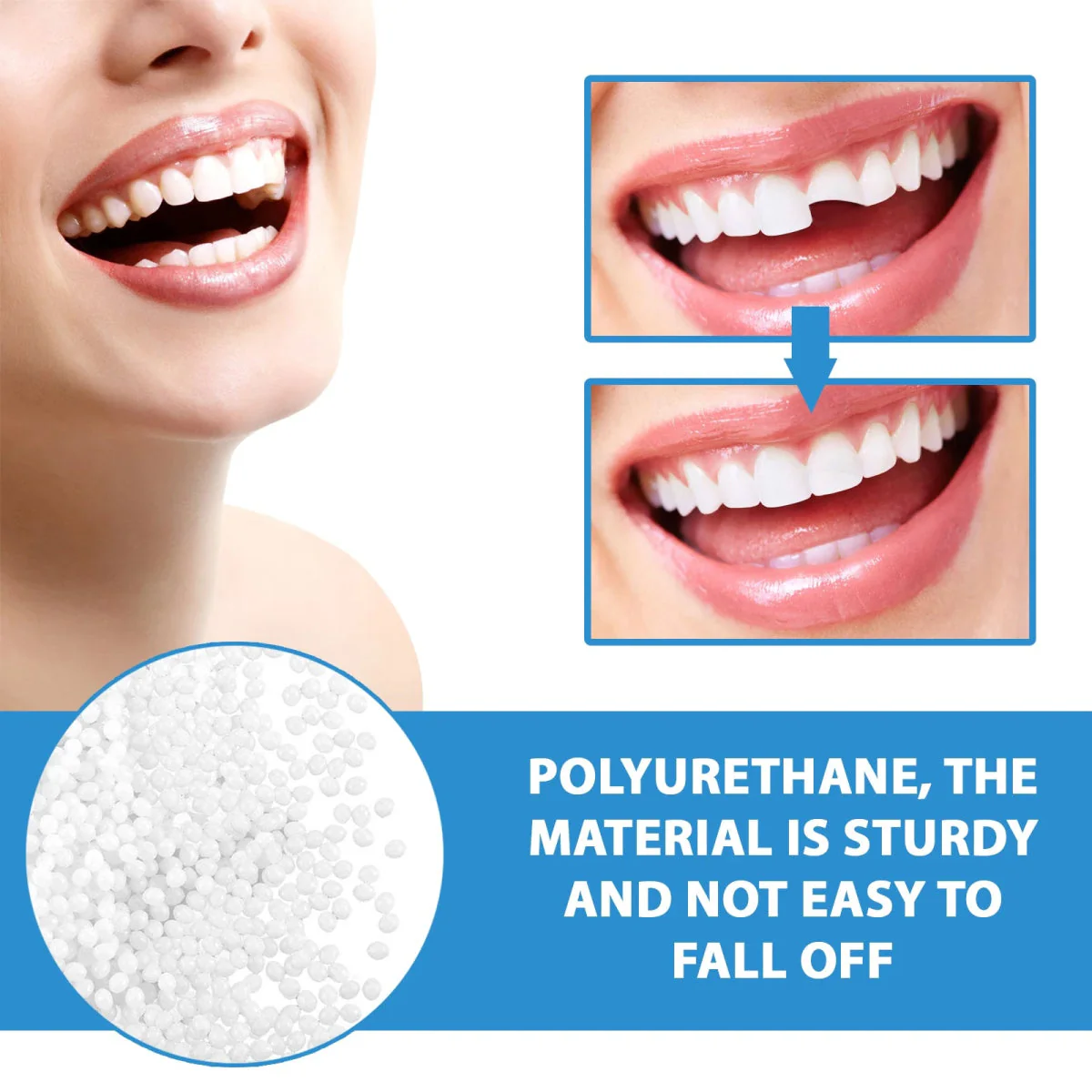 InstantSmile™ — Confidently Fill Gaps and Shine Bright Anywhere, Anytime - Image 9