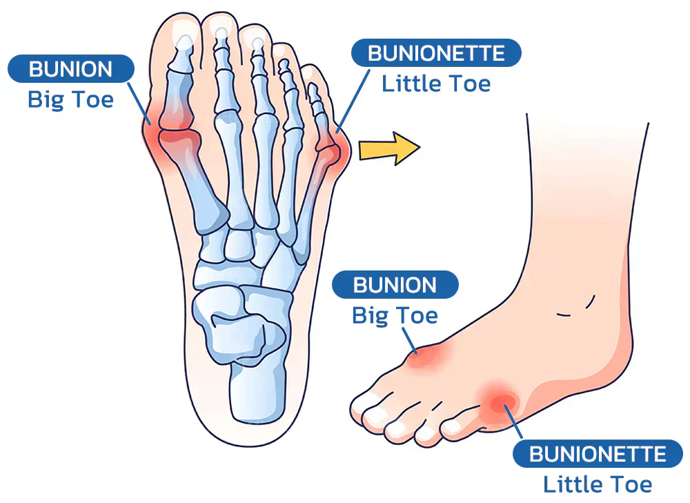 ComfortFoot™ Orthopedic Socks (2+1 Free) - Image 3