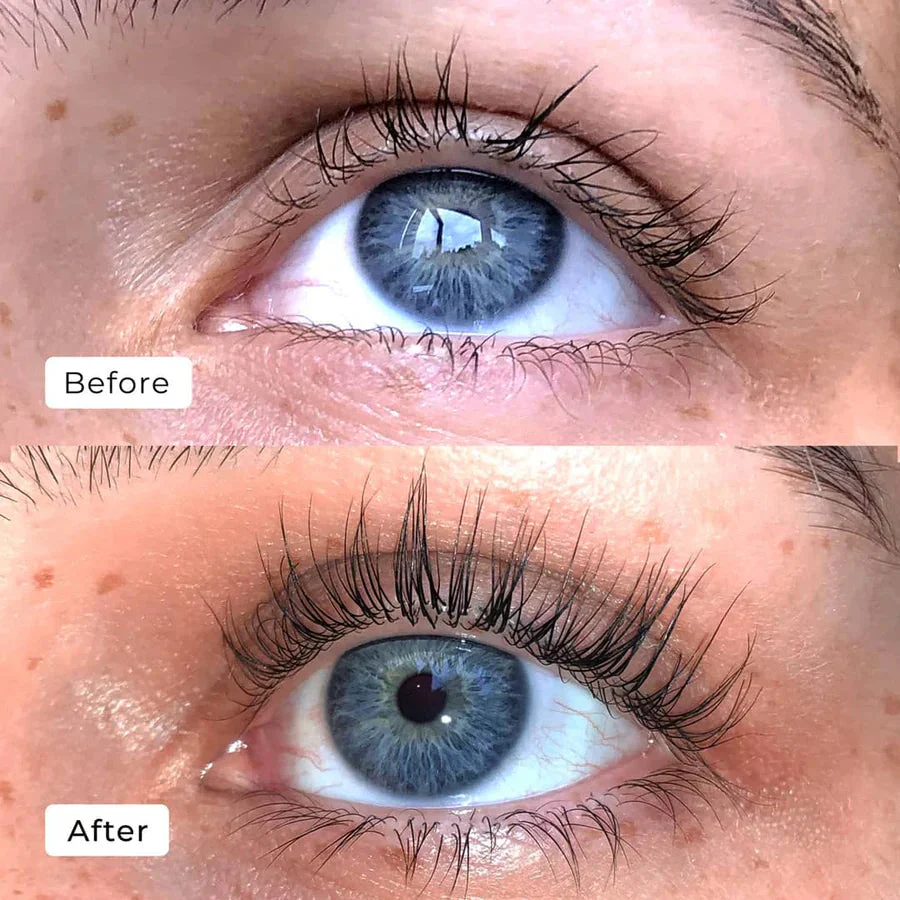 LashAura™ — Wake Up to Naturally Bold, Head-Turning Lashes in Just One Week - Image 2
