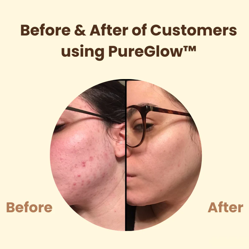 Last Day 50% OFF🔥 | PureGlow™ Black Tea Mask - Image 3