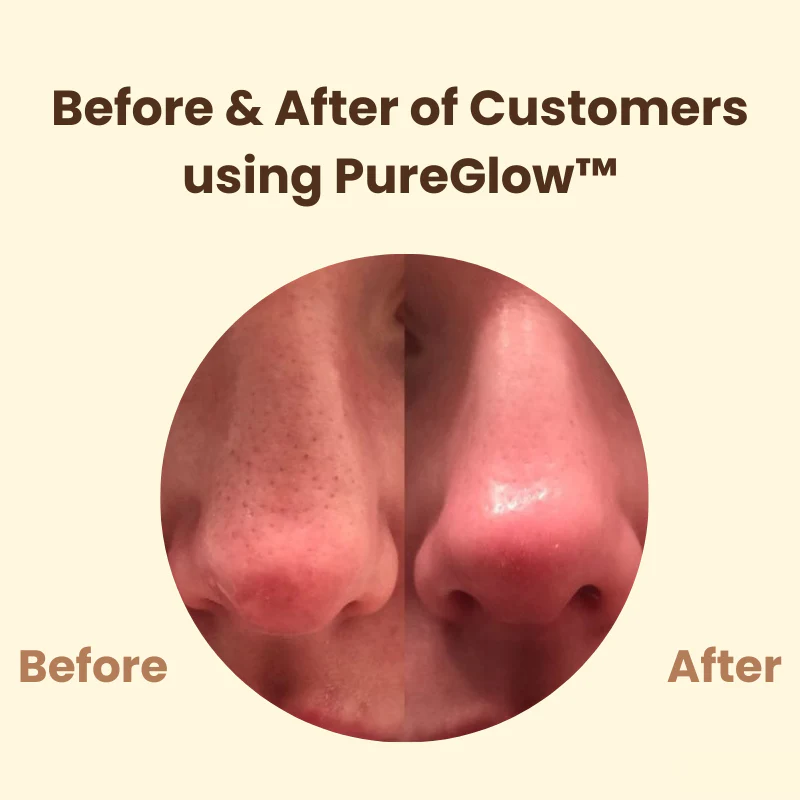 Last Day 50% OFF🔥 | PureGlow™ Black Tea Mask - Image 4