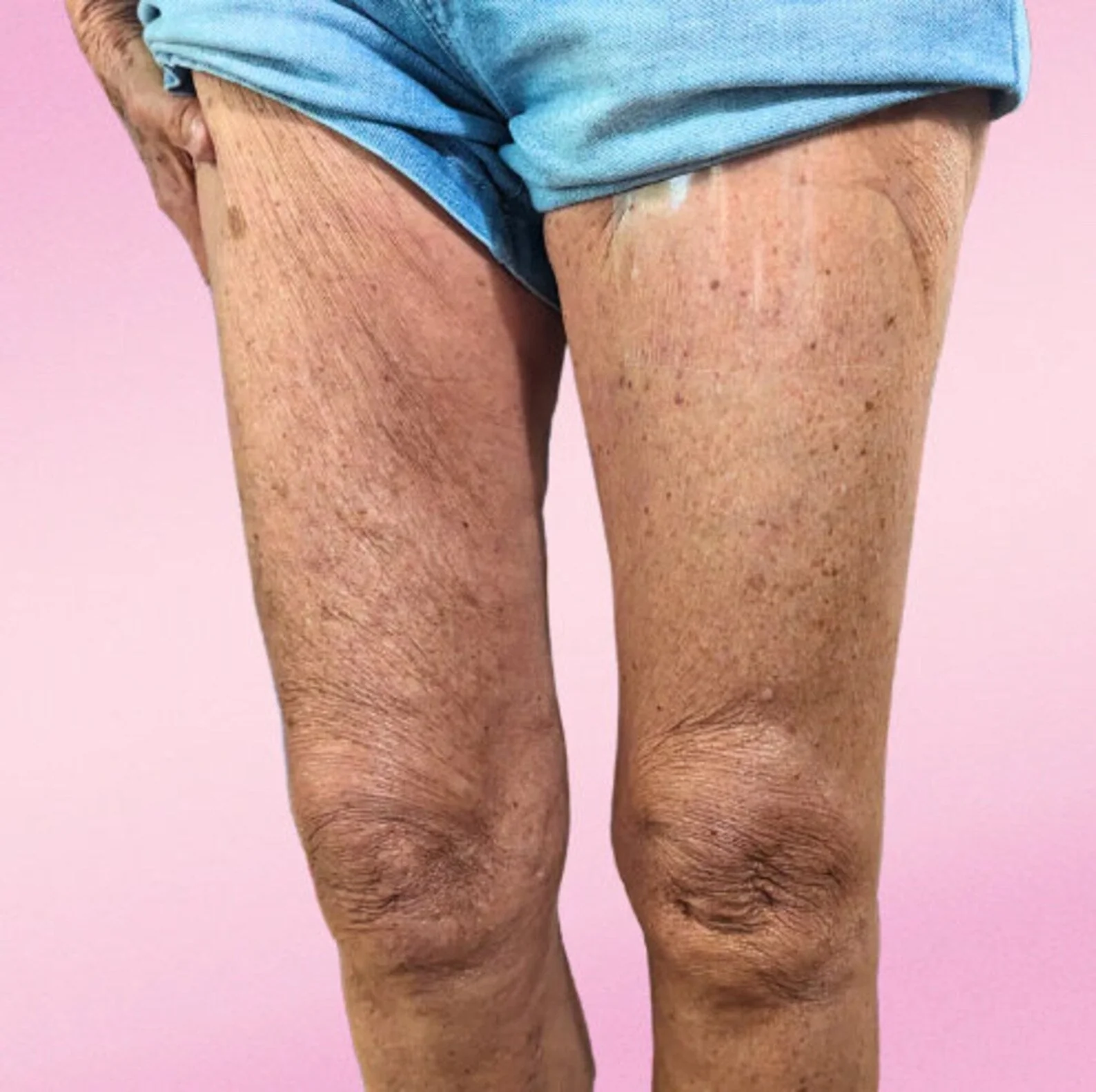 LiftAura™ — Instantly Tighten & Smooth Skin for All-Day Confidence - Image 6