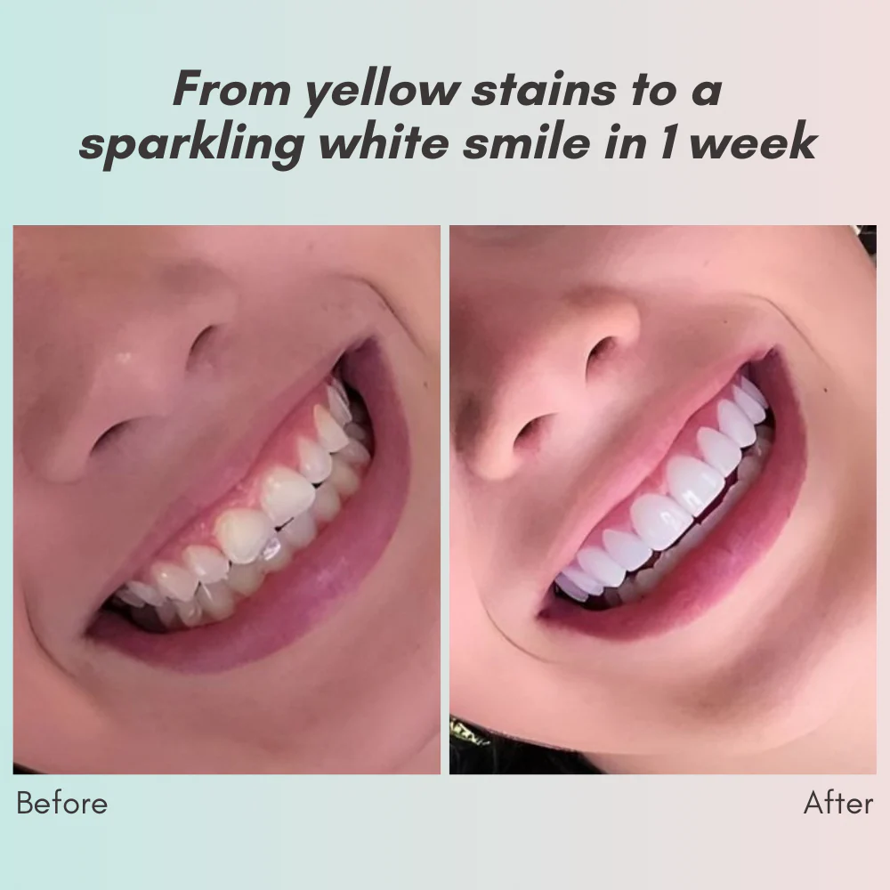 LumaCrest™ — Unleash a Radiant Smile and Heal Your Gums for Lasting Confidence - Image 3