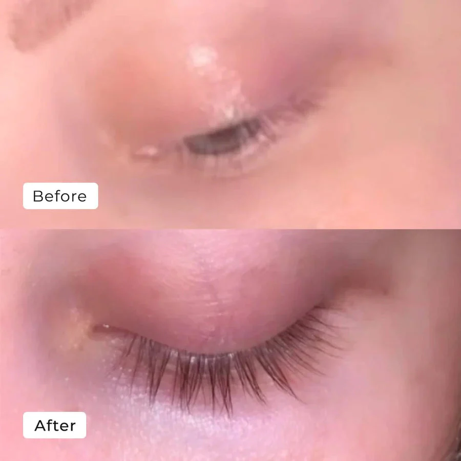 LumaLash™ — Wake Up to Naturally Thicker, Fuller Lashes in Just 7 Days - Image 5