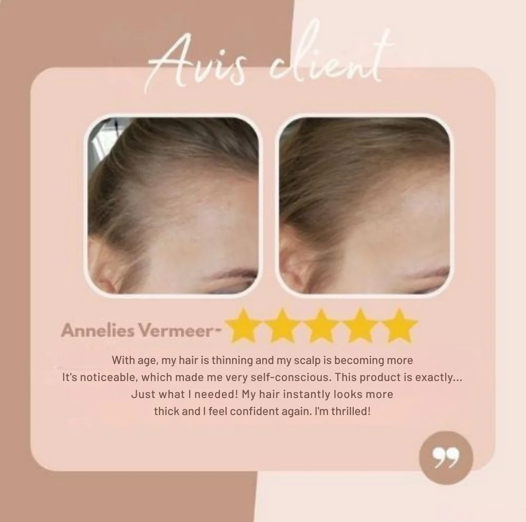 LumaVeil™ — Unlock Flawless, Natural-Looking Hair That Boosts Your Confidence Instantly - Image 5