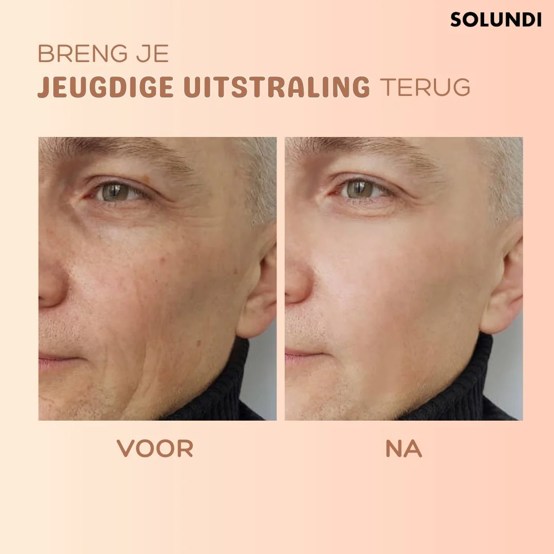 LumeaSilk™ — Instantly Erase Wrinkles and Glow with Youthful Confidence - Image 6