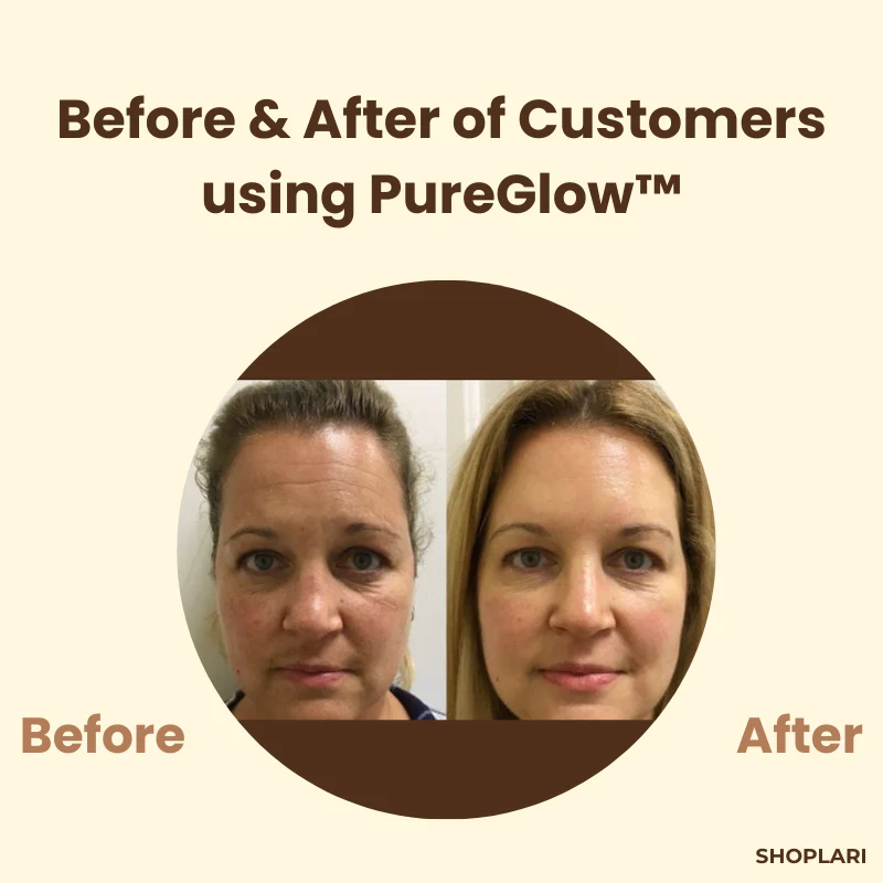 LumiVita™ Black Tea Mask — Unleash Radiant, Flawless Skin That Commands Attention - Image 5
