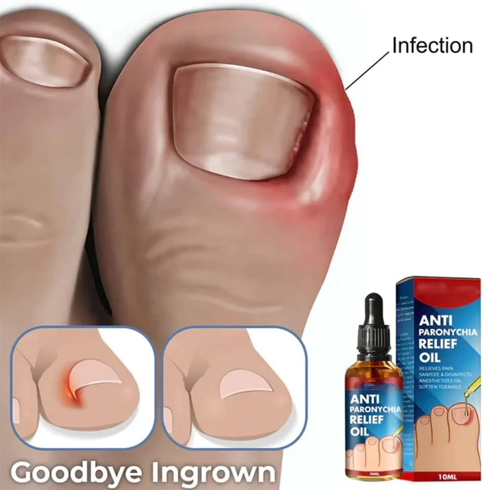 NailCure™ — Unleash Stunningly Strong Nails That Command Attention in Just Weeks