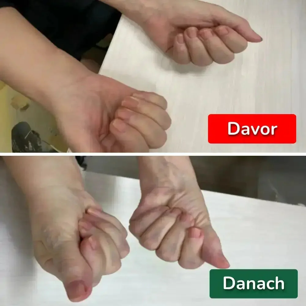 NeutraWrist™ — End Wrist Pain Fast and Take Back Your Freedom - Image 7
