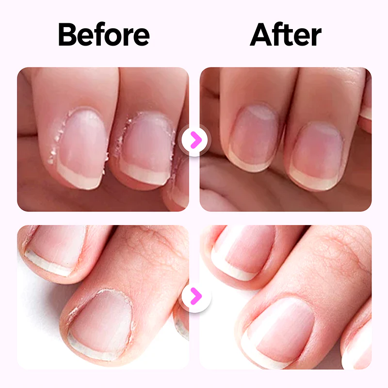 NuNail™ Precision Pen — Unlock Flawless, Strong Nails with Effortless Elegance - Image 2
