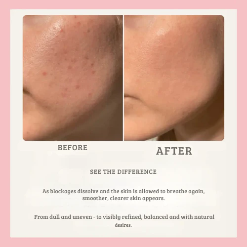 PoreVanta™ — Unlock Radiant Skin by Clearing Deep Pores for a Glow You’ll Love - Image 4