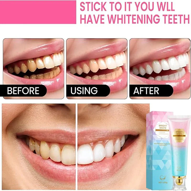 RadiancePlus™ Niacinamide Whitening Toothpaste — Transform Your Smile with Soothing, Powerful Brightness - Image 3
