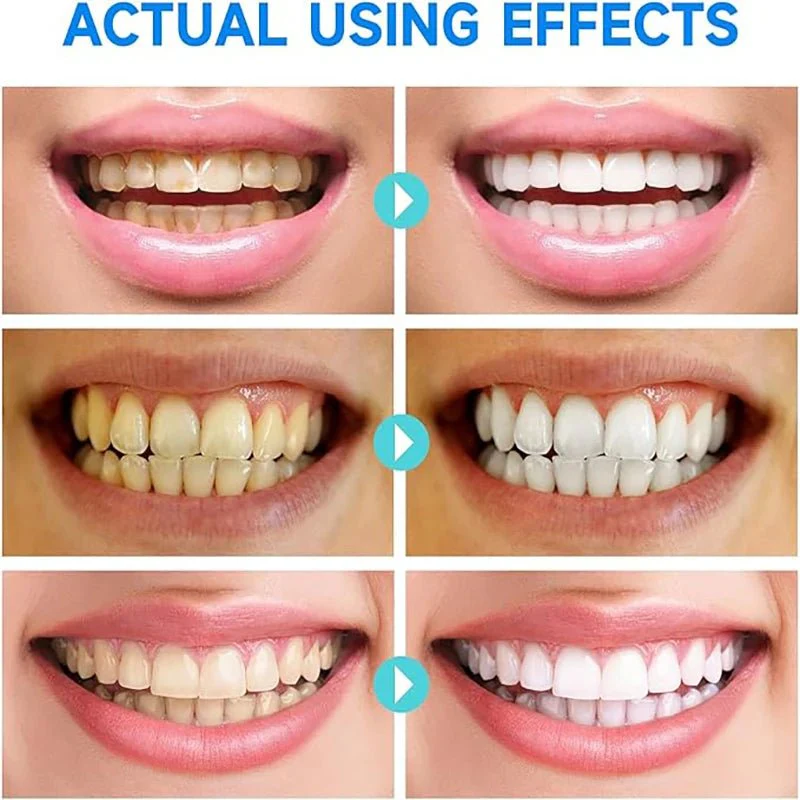 RadiancePlus™ Niacinamide Whitening Toothpaste — Transform Your Smile with Soothing, Powerful Brightness - Image 4