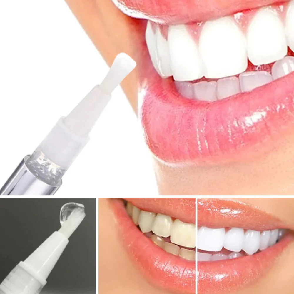 RadianceRush™ — Light Up Every Room with a Smile That Shines Confidence - Image 5