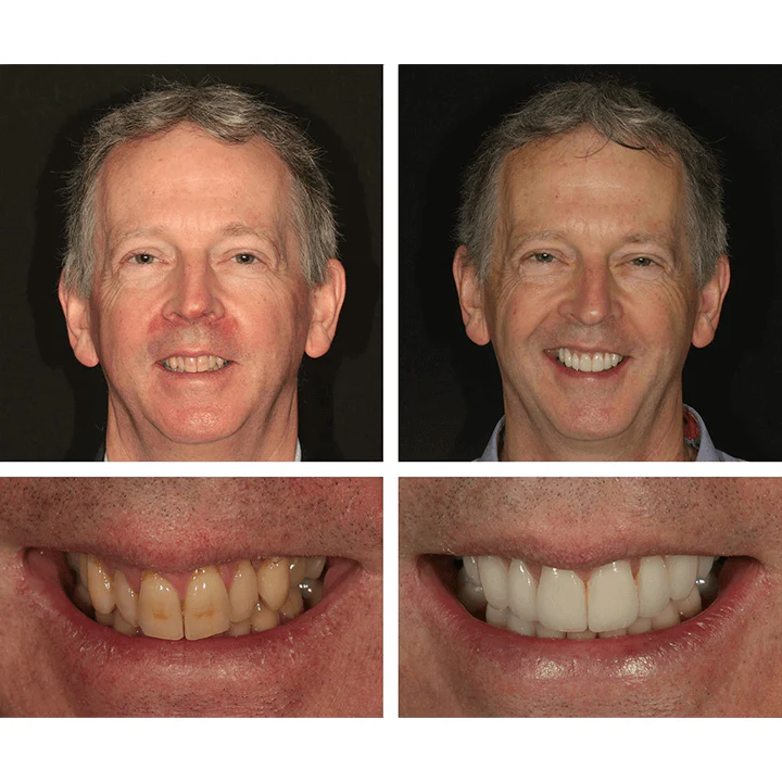 RadiantPearl™ Whitening Essence — Brighten Your Smile with Gentle, Head-Turning Confidence - Image 11