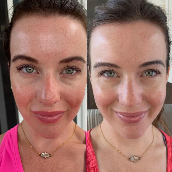 RadiantWave™ Mask — Unlock Your Skin’s Natural Glow with Effortless, Spa-Quality Care - Image 7