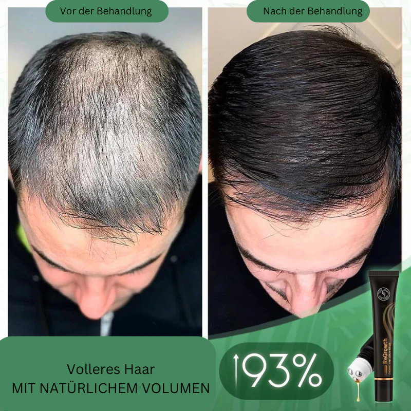 RamiraFortis™ — Ignite Your Scalp to Reveal Fuller, Thicker Hair That Commands Attention - Image 4