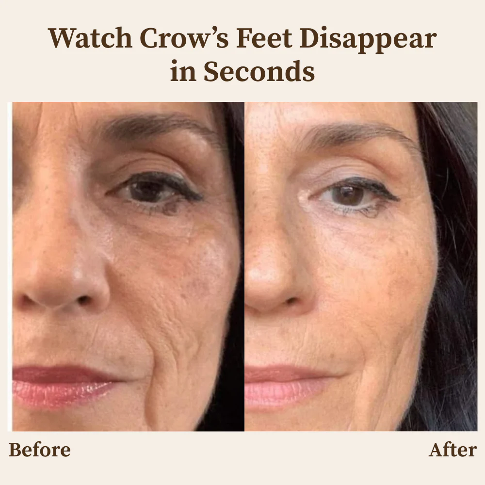 RamoraLift™ — Reveal Youthful, Radiant Skin That Defies Time Instantly - Image 2