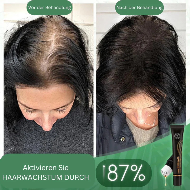 RamoraVive™ — Unlock Lush, Head-Turning Hair That Powers Your Confidence - Image 3