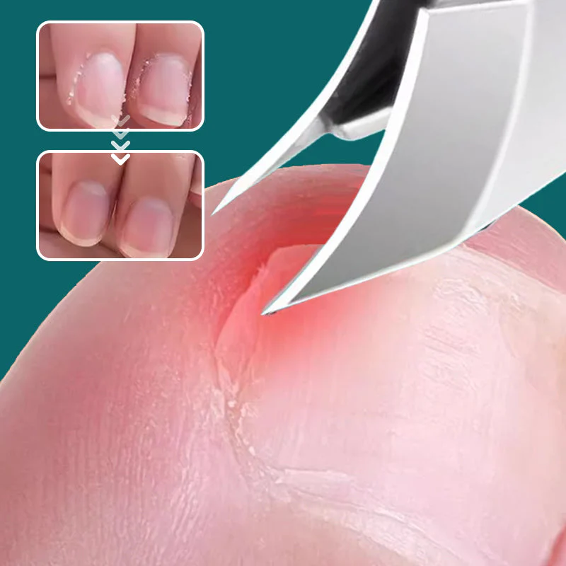 RazorSharp™ Nail Trimming Set — Experience Perfectly Clean Nails Without the Mess or Hassle - Image 4