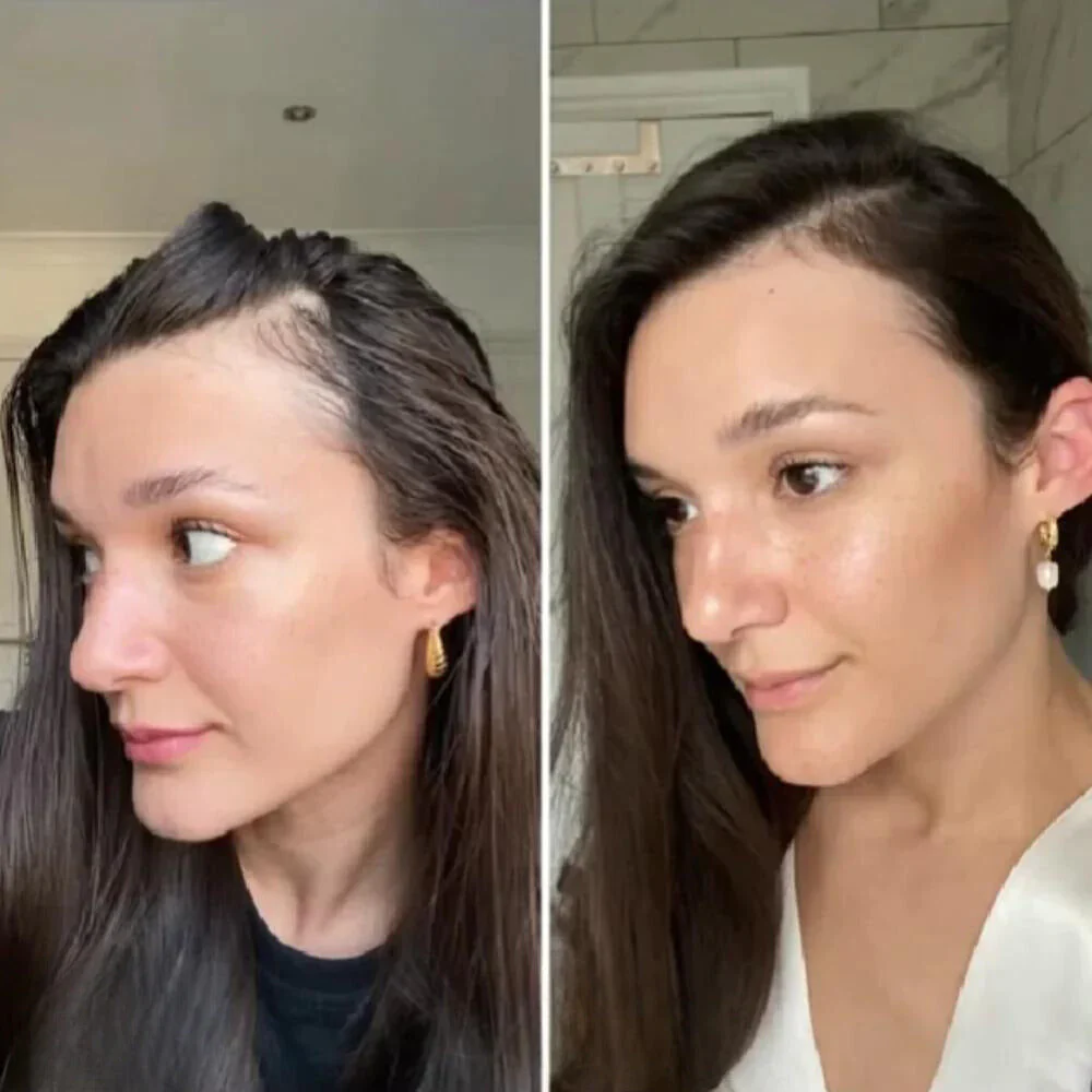 RevitaLeaf™ — Unlock Thick, Lush Hair That Rebuilds Your Confidence - Image 3