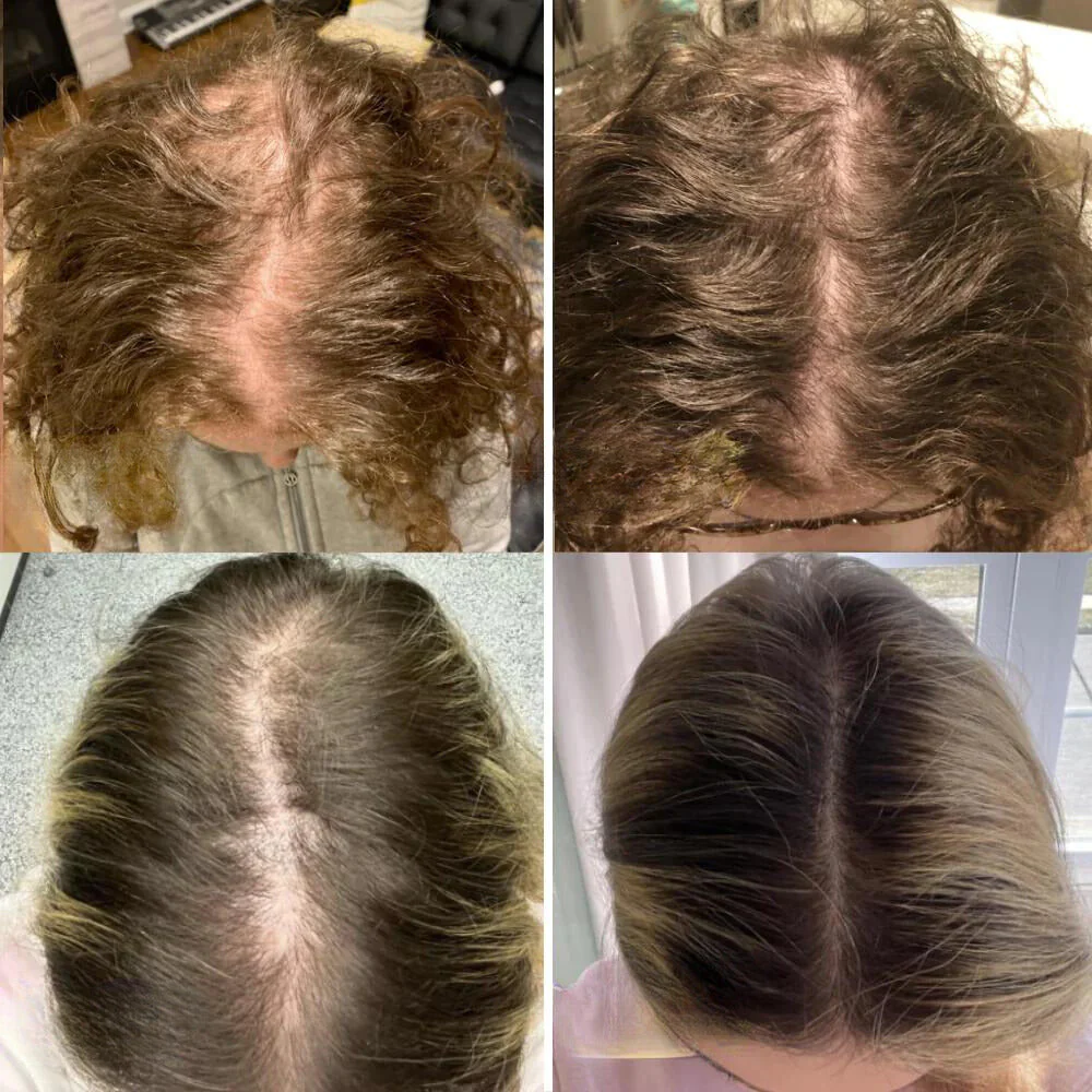RevitaLeaf™ — Unlock Thick, Lush Hair That Rebuilds Your Confidence - Image 4