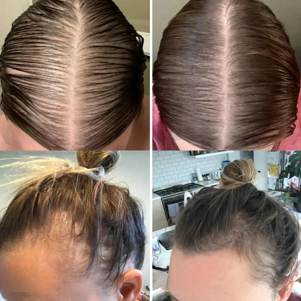 RevitaLeaf™ — Unlock Thick, Lush Hair That Rebuilds Your Confidence - Image 5